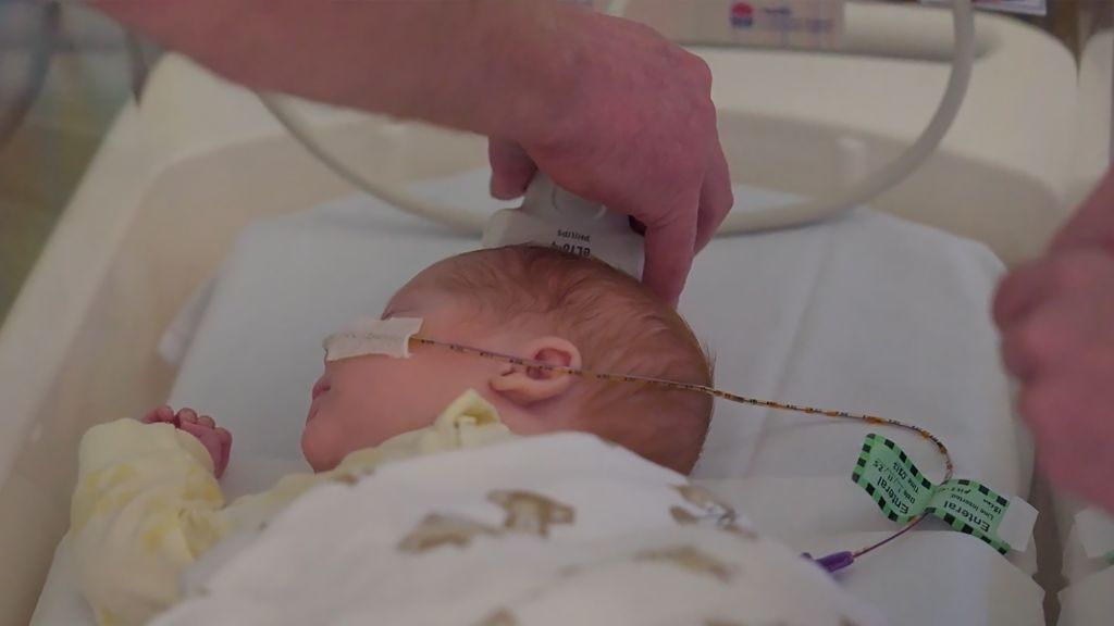 6385336870112 coal-community-partners-neonatal